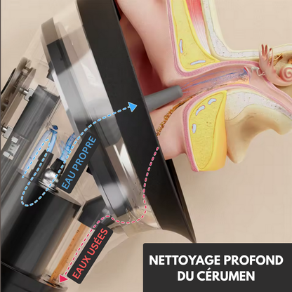 Appareil de nettoyage d'oreilles Elorias